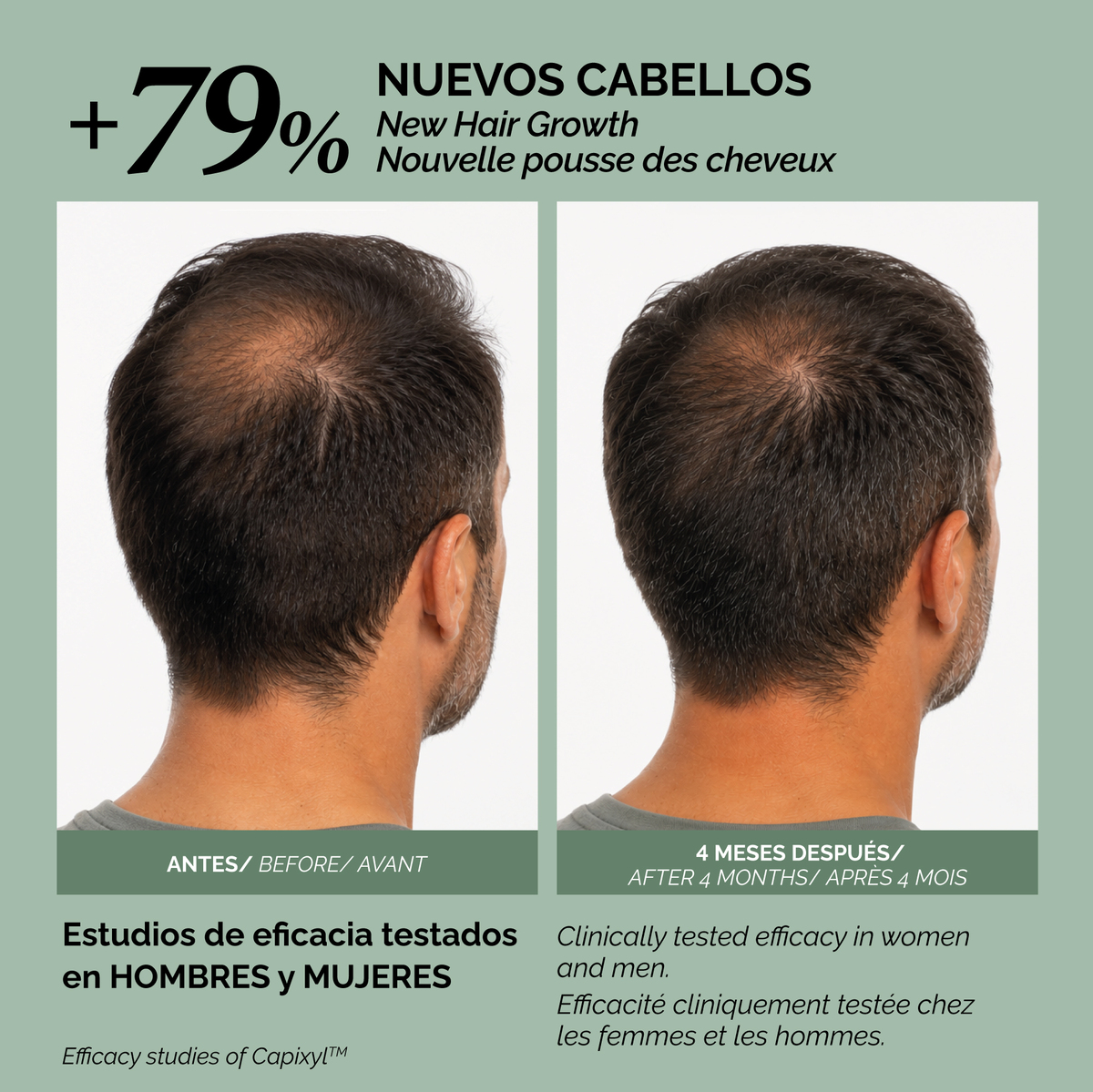 Loción anticaída Capixyl 100 ml - Imagen 2
