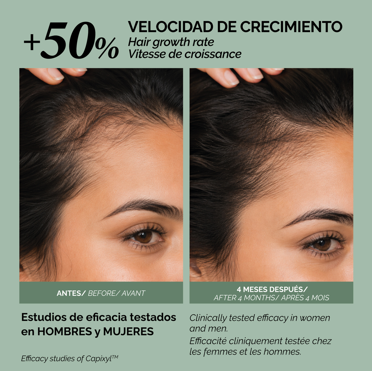 Loción anticaída Capixyl 100 ml - Imagen 3